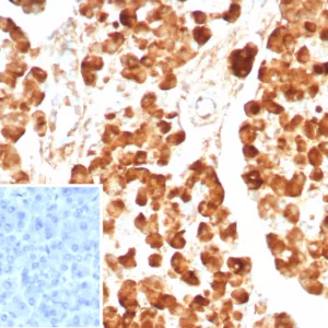 Formalin-fixed, paraffin-embedded human pancreas stained with CPA1 Recombinant Rabbit Monoclonal Antibody (CPA1/8624R). Inset: PBS instead of primary antibody; secondary only negative control.