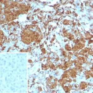 Formalin-fixed, paraffin-embedded human pancreas stained with CPA1 Recombinant Rabbit Monoclonal Antibody (CPA1/8258R). Inset: PBS instead of primary antibody; secondary only negative control.