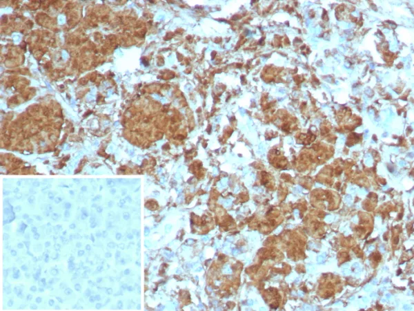 Formalin-fixed, paraffin-embedded human pancreas stained with CPA1 Recombinant Rabbit Monoclonal Antibody (CPA1/8258R). Inset: PBS instead of primary antibody; secondary only negative control.