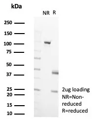 SDS-PAGE Analysis of Purified CD35 Recombinant Mouse Monoclonal Antibody (rCR1/8596). Confirmation of Purity and Integrity of Antibody.