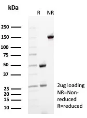 SDS-PAGE Analysis of Purified CD35 Recombinant Mouse Monoclonal Antibody (rCR1/8597). Confirmation of Purity and Integrity of Antibody.