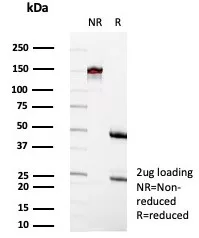 SDS-PAGE Analysis of Purified CD35 Recombinant Mouse Monoclonal Antibody (rCR1/8599). Confirmation of Purity and Integrity of Antibody.