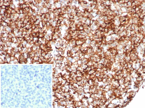 Formalin-fixed, paraffin-embedded human tonsil stained with CD35 Recombinant Mouse Monoclonal Antibody (rCR1/8600). Inset: PBS instead of primary antibody; secondary only negative control.