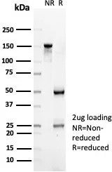 SDS-PAGE Analysis of Purified CD35 Mouse Monoclonal Antibody (CR1/6379). Confirmation of Purity and Integrity of Antibody.