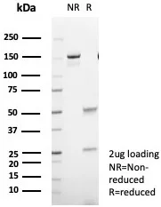 SDS-PAGE Analysis of Purified CD35 Recombinant Rabbit Monoclonal Antibody (CR1/8244R). Confirmation of Purity and Integrity of Antibody.