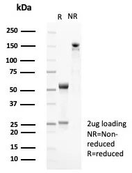 SDS-PAGE Analysis of Purified CD35 Recombinant Rabbit Monoclonal Antibody (CR1/8282R). Confirmation of Purity and Integrity of Antibody.
