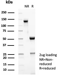 SDS-PAGE Analysis of Purified CD35 Recombinant Rabbit Monoclonal Antibody (CR1/8283R). Confirmation of Purity and Integrity of Antibody.