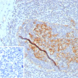 Formalin-fixed, paraffin-embedded human tonsil stained with CD35 Recombinant Rabbit Monoclonal Antibody (CR1/8223R). Inset: PBS instead of primary antibody; secondary only negative control.
