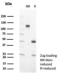 SDS-PAGE Analysis of Purified CD35 Recombinant Rabbit Monoclonal Antibody (CR1/8598R). Confirmation of Purity and Integrity of Antibody.