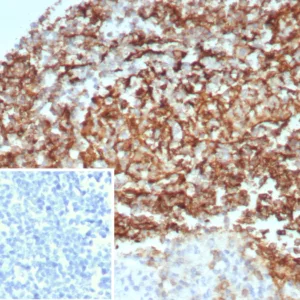 Formalin-fixed, paraffin-embedded human kidney stained with CD35 Recombinant Rabbit Monoclonal Antibody (CD35/8674R) at 2ug/ml. Inset: PBS instead of primary antibody; secondary only negative control.