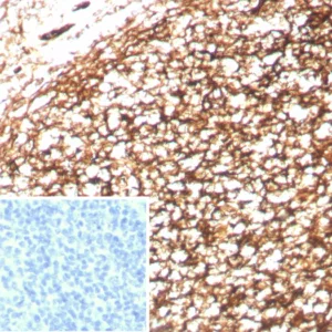 Formalin-fixed, paraffin-embedded human tonsil stained with CD35 Recombinant Rabbit Monoclonal Antibody (CD35/8833R). Inset: PBS instead of primary antibody; secondary only negative control.