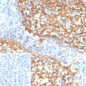 Formalin-fixed, paraffin-embedded human tonsil stained with CD21 Recombinant Rabbit Monoclonal Antibody (CR2/7185R). Inset: PBS instead of primary antibody; secondary only negative control.