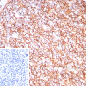 Formalin-fixed, paraffin-embedded human tonsil stained with CD21 Recombinant Rabbit Monoclonal Antibody (CR2/8880R). Inset: PBS instead of primary antibody; secondary only negative control.