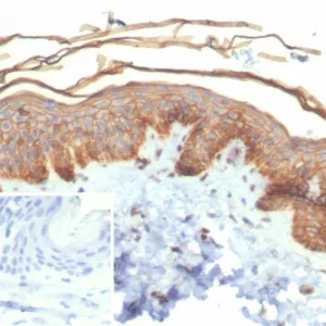 Formalin-fixed, paraffin-embedded human duodenum stained with S100A16 Mouse Monoclonal Antibody (S100A16/7411). HIER: Tris/EDTA, pH9.0, 45min. 2°C: HRP-polymer, 30min. DAB, 5min.