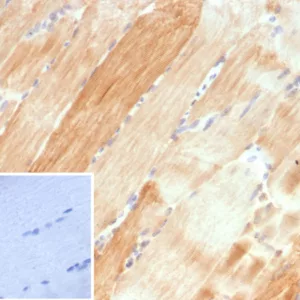 Formalin-fixed, paraffin-embedded human skeletal muscle stained with Crystallin Alpha B Mouse Monoclonal Antibody (CRYAB/4661). Inset: PBS instead of primary antibody; secondary only negative control.