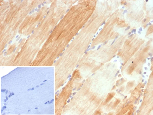 Formalin-fixed, paraffin-embedded human skeletal muscle stained with Crystallin Alpha B Mouse Monoclonal Antibody (CRYAB/4661). Inset: PBS instead of primary antibody; secondary only negative control.