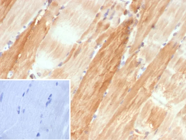 Formalin-fixed, paraffin-embedded human skeletal muscle stained with Crystallin Alpha B Mouse Monoclonal Antibody (CRYAB/4662). HIER: Tris/EDTA, pH9.0, 45min. 2°C: HRP-polymer, 30min. DAB, 5min.
