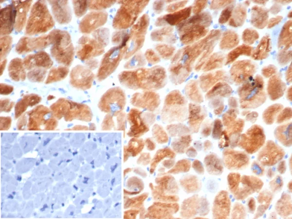 Formalin-fixed, paraffin-embedded human heart stained with Crystallin Alpha B Mouse Monoclonal Antibody (CRYAB/4663). Inset: PBS instead of primary antibody; secondary only negative control.
