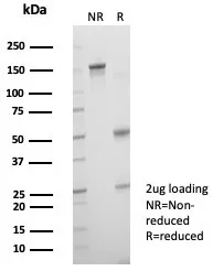 SDS-PAGE Analysis of Purified Crystallin Alpha B Mouse Monoclonal Antibody (CRYAB/4666). Confirmation of Purity and Integrity of Antibody.