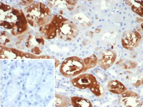 Formalin-fixed, paraffin-embedded human kidney stained with Crystallin Alpha B Mouse Monoclonal Antibody (CRYAB/4666). Inset: PBS instead of primary antibody; secondary only negative control.