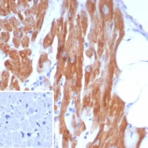 Formalin-fixed, paraffin-embedded human heart stained with Crystallin Alpha B Mouse Monoclonal Antibody (CRYAB/7917). Inset: PBS instead of primary antibody; secondary only negative control.