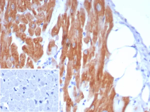 Formalin-fixed, paraffin-embedded human heart stained with Crystallin Alpha B Mouse Monoclonal Antibody (CRYAB/7917). Inset: PBS instead of primary antibody; secondary only negative control.