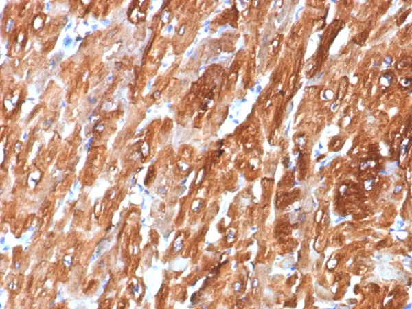 Formalin-fixed, paraffin-embedded human heart stained with Crystallin Alpha B Mouse Monoclonal Antibody (CRYAB/7918). HIER: Tris/EDTA, pH9.0, 45min. 2°C: HRP-polymer, 30min. DAB, 5min.