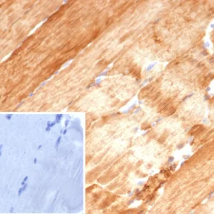 Formalin-fixed, paraffin-embedded human skeletal muscle stained with Crystallin Alpha B Mouse Monoclonal Antibody (CRYAB/4657). Inset: PBS instead of primary antibody; secondary only negative control.