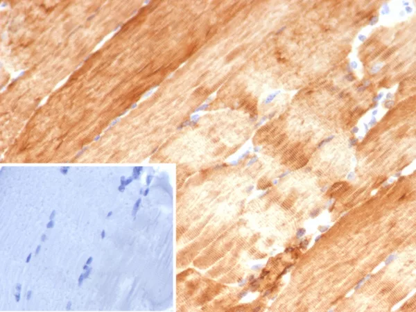 Formalin-fixed, paraffin-embedded human skeletal muscle stained with Crystallin Alpha B Mouse Monoclonal Antibody (CRYAB/4657). Inset: PBS instead of primary antibody; secondary only negative control.