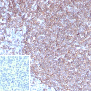 Formalin-fixed, paraffin-embedded human tonsil stained with G-CSF Mouse Monoclonal Antibody (CSF3/4597).  Inset: PBS instead of primary antibody; secondary only negative control.
