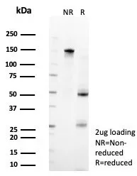 SDS-PAGE Analysis of Purified ZFP90 Mouse Monoclonal Antibody (PCRP-ZFP90-1C5). Confirmation of Purity and Integrity of Antibody.