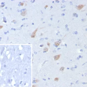 Formalin-fixed, paraffin-embedded human brain stained with NeuN Recombinant Mouse Monoclonal Antibody (rNEUN/8055). Inset: PBS instead of primary antibody; secondary only negative control.