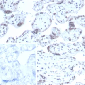 Formalin-fixed, paraffin-embedded human placenta stained with NeuN Mouse Monoclonal Antibody (NEUN/7167). Inset: PBS instead of primary antibody; secondary only negative control.