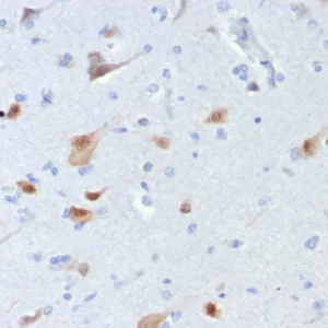 Formalin-fixed, paraffin-embedded human brain stained with NeuN Recombinant Mouse Monoclonal Antibody (rNEUN/8054). HIER: Tris/EDTA, pH9.0, 45min. 2°C: HRP-polymer, 30min. DAB, 5min.