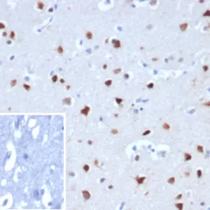 Formalin-fixed, paraffin-embedded human cerebellum stained with NeuN Recombinant Rabbit Monoclonal Antibody (NEUN/8096R). Inset: PBS instead of primary antibody; secondary only negative control.