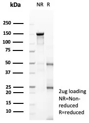 SDS-PAGE Analysis of Purified NeuN Recombinant Rabbit Monoclonal Antibody (NEUN/8096R). Confirmation of Purity and Integrity of Antibody. Recombinant Neuronal-Nuclei (NeuN) (Neuronal Marker) Antibody - Image 2