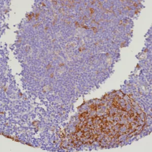 Formalin-fixed, paraffin-embedded human lymph node stained with Cystatin A Recombinant Rabbit Monoclonal Antibody (CSTA/9087R). HIER: Tris/EDTA, pH9.0, 45min. 2°C: HRP-polymer, 30min. DAB, 5min.