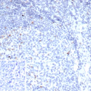 Formalin-fixed, paraffin-embedded human tonsil stained with CTLA4 Recombinant Mouse Monoclonal Antibody (rCTLA4/7219). Inset: PBS instead of primary antibody; secondary only negative control.