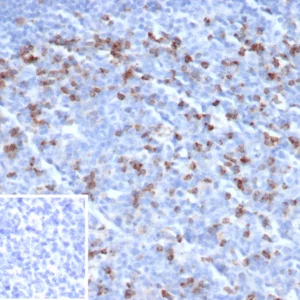 Formalin-fixed, paraffin-embedded human tonsil stained with CTLA4 Recombinant Rabbit Monoclonal Antibody (CTLA4/6864R). Inset: PBS instead of primary antibody; secondary only negative control.