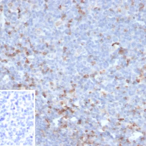 Formalin-fixed, paraffin-embedded human tonsil stained with CTLA4 Recombinant Rabbit Monoclonal Antibody (CTLA4/6867R). Inset: PBS instead of primary antibody; secondary only negative control.