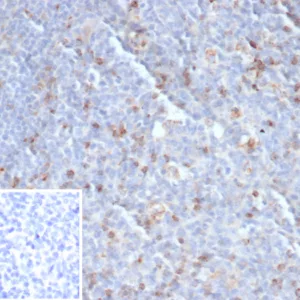 Formalin-fixed, paraffin-embedded human tonsil stained with CTLA4 Recombinant Rabbit Monoclonal Antibody (CTLA4/6868R). Inset: PBS instead of primary antibody; secondary only negative control.