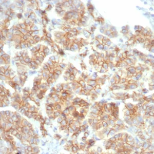 Formalin-fixed, paraffin-embedded human salivary gland stained with Beta-Catenin Mouse Monoclonal Antibody (CTNNB1/7759). HIER: Tris/EDTA, pH9.0, 45min. 2°C: HRP-polymer, 30min. DAB, 5min.