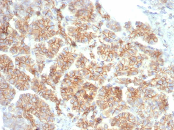 Formalin-fixed, paraffin-embedded human salivary gland stained with Beta-Catenin Mouse Monoclonal Antibody (CTNNB1/7759). HIER: Tris/EDTA, pH9.0, 45min. 2°C: HRP-polymer, 30min. DAB, 5min.