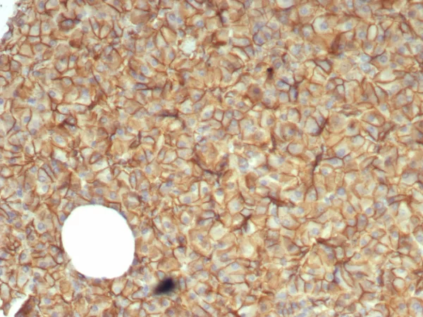 Formalin-fixed, paraffin-embedded human pancreas stained with Beta-Catenin Mouse Monoclonal Antibody (CTNNB1/7760). HIER: Tris/EDTA, pH9.0, 45min. 2°C: HRP-polymer, 30min. DAB, 5min.