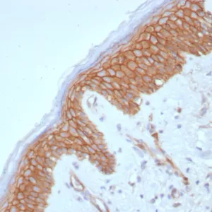 Formalin-fixed, paraffin-embedded human skin stained with  Beta-Catenin Recombinant Rabbit Monoclonal Antibody (CTNNB1/8280R). HIER: Tris/EDTA, pH9.0, 45min. 2°C: HRP-polymer, 30min. DAB, 5min.