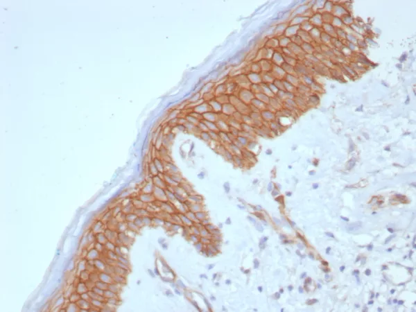 Formalin-fixed, paraffin-embedded human skin stained with  Beta-Catenin Recombinant Rabbit Monoclonal Antibody (CTNNB1/8280R). HIER: Tris/EDTA, pH9.0, 45min. 2°C: HRP-polymer, 30min. DAB, 5min.