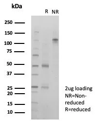 SDS-PAGE Analysis of Purified DAXX Mouse Monoclonal Antibody (PCRP-DAXX-6E11). Confirmation of Purity and Integrity of Antibody.