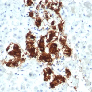 Formalin-fixed, paraffin-embedded human adrenal gland stained with Dopamine Beta-Hydroxylase Mouse Monoclonal Antibody (DBH/7222). HIER: Tris/EDTA, pH9.0, 45min. 2°C: HRP-polymer, 30min. DAB, 5min.