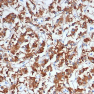 Formalin-fixed, paraffin-embedded human adrenal gland stained with Dopamine Beta-Hydroxylase Mouse Monoclonal Antibody (DBH/7224). HIER: Tris/EDTA, pH9.0, 45min. 2°C: HRP-polymer, 30min. DAB, 5min.