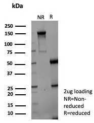 SDS-PAGE Analysis of Purified AKR1C1 Mouse Monoclonal Antibody (AKR1C1/9070). Confirmation of Purity and Integrity of Antibody.